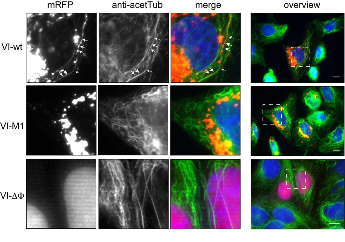Subcellular localization of protein VI.