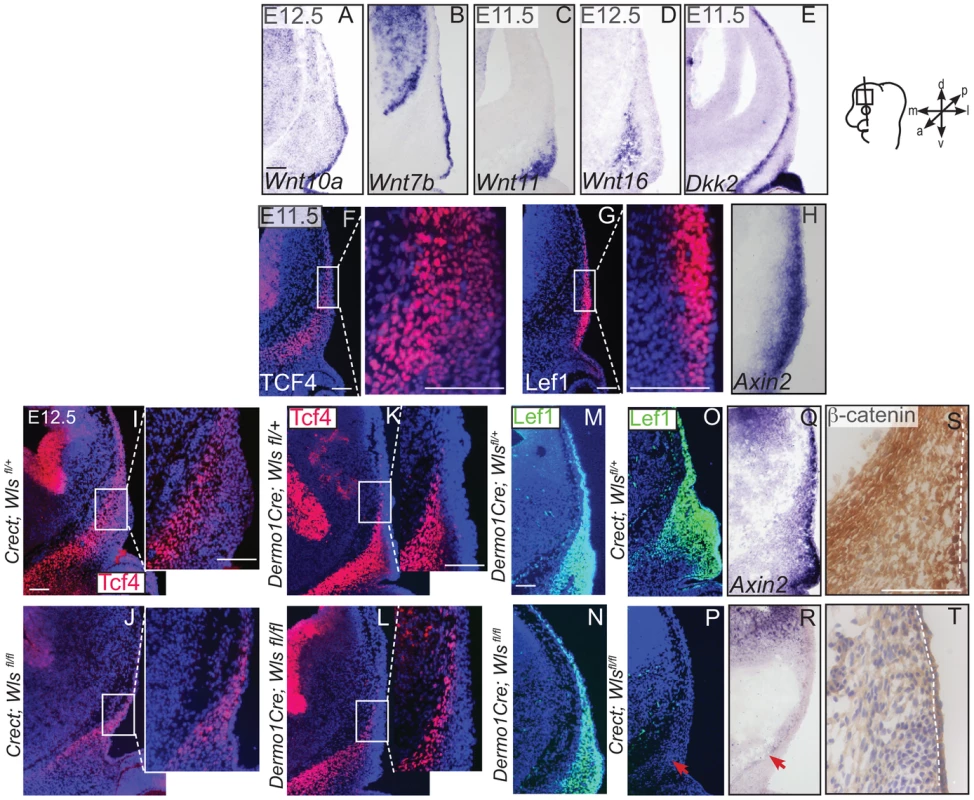 Generation of Wnt responsiveness in the cranial mesenchyme.