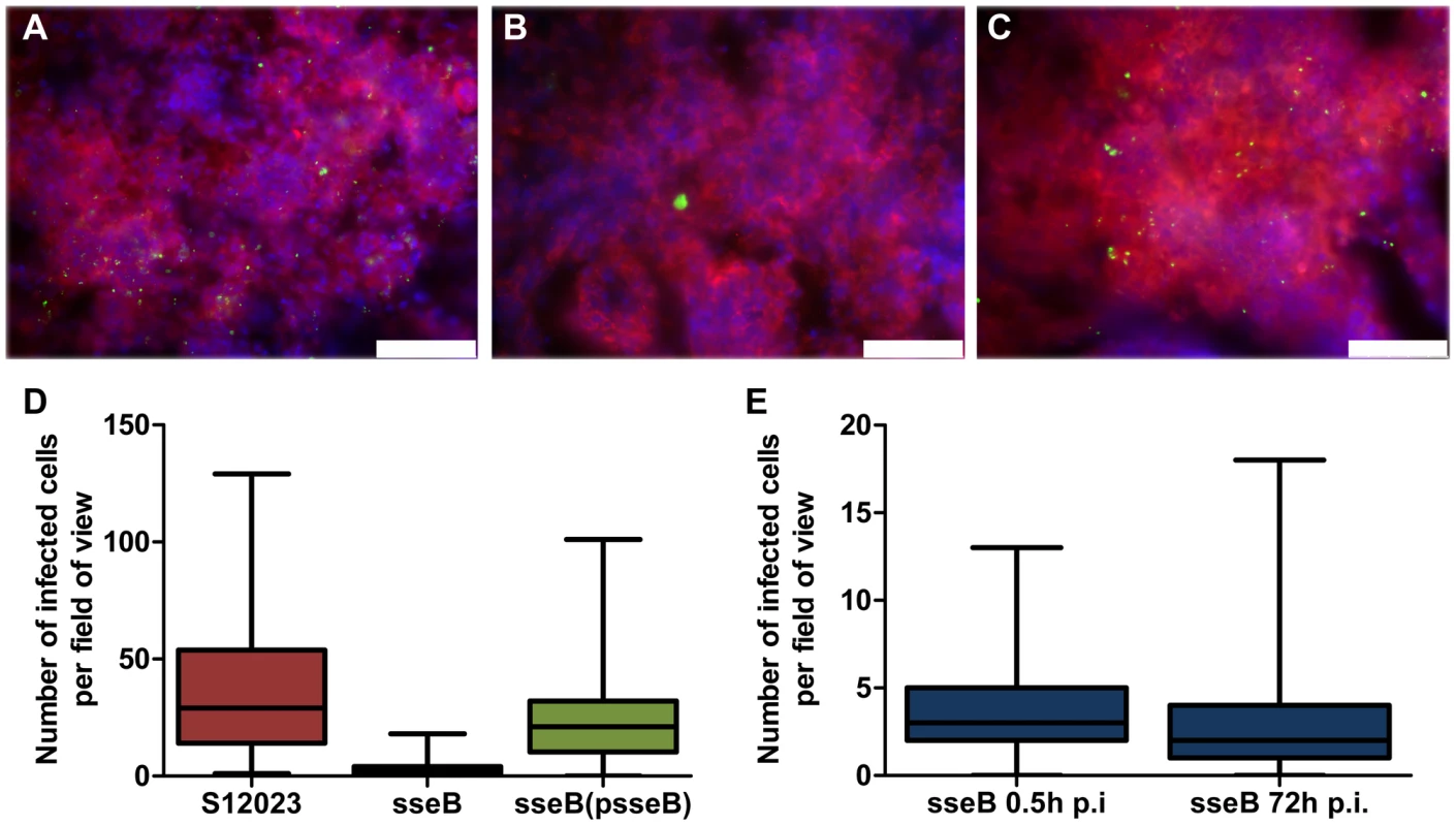 SPI-2 T3SS mutants are present in far fewer infected foci per organ than the wild-type.