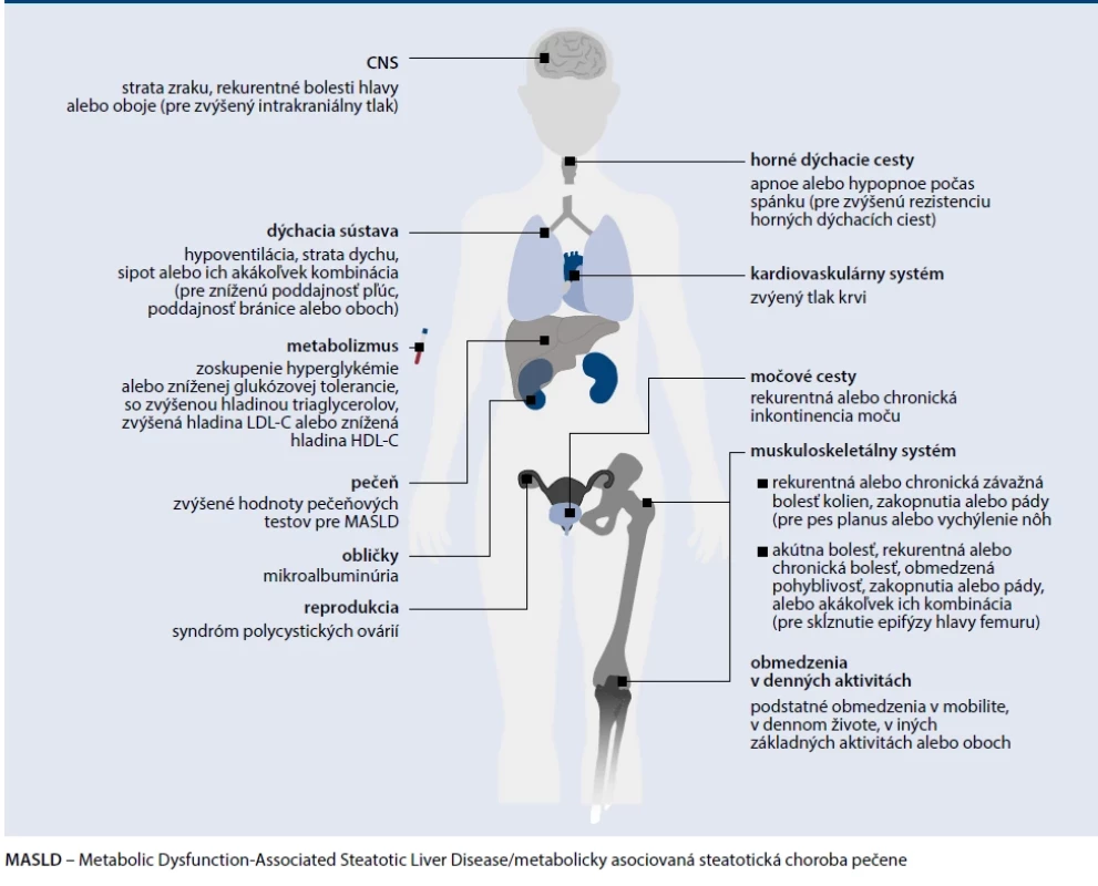 Diagnostické kritéria pre klinickú obezitu v detskom veku a adolescencii.