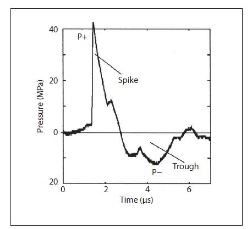 Rozložení fází rázové vlny (převzato z Wein A, Kavoussi L, et al. Campbell-Walsh Urology, 9<sup>th</sup> ed. Philadelphia: Saunders 2007)
Fig. 2. Phases of shock wave