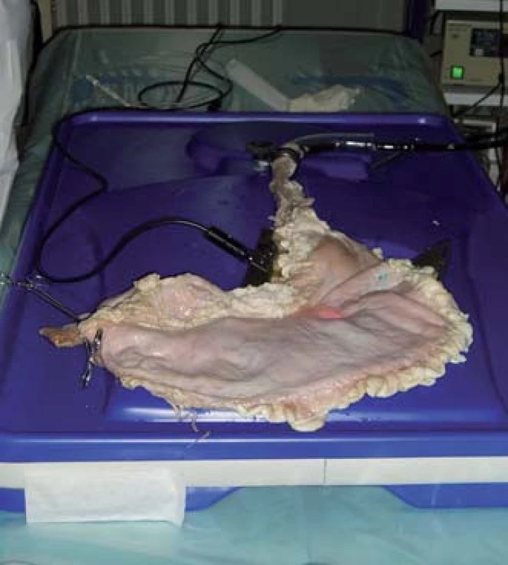 Erlangenský model žaludku vhodný k tréninku rozličných endoskopických metod.
Fig. 14. Erlangen stomach model suitable for training in various endoscopic methods.