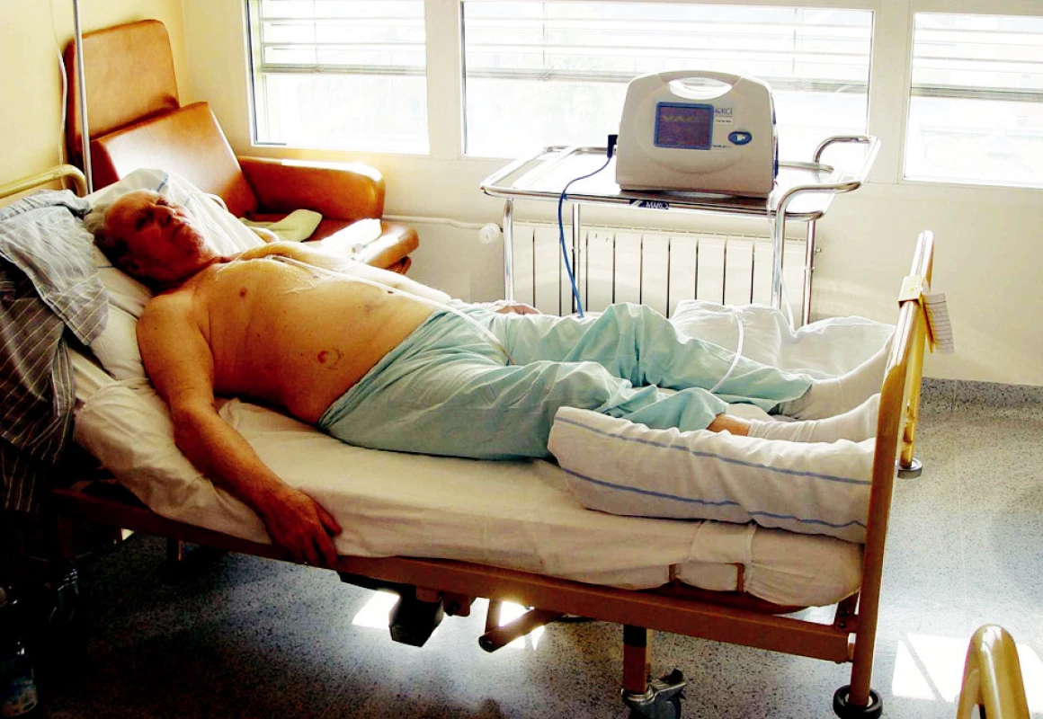 Nemocný s hlubokou sternální infekcí během VAC terapie
Fig. 4. The patient with deep sternal infection on the VAC therapy