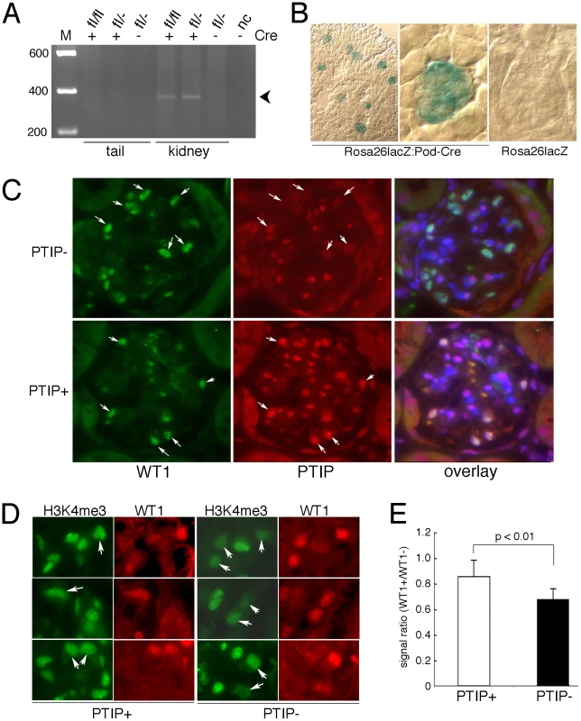Generation of a Podocyte-Specific <i>Paxip1</i> Deletion.