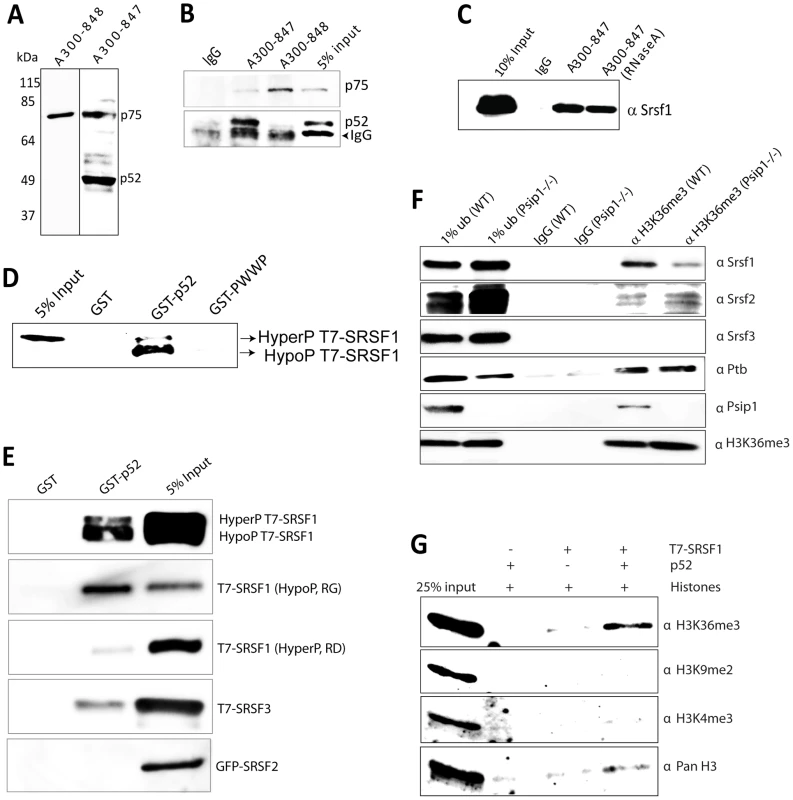 Immunoprecipitation of Psip1/p52 and p75.