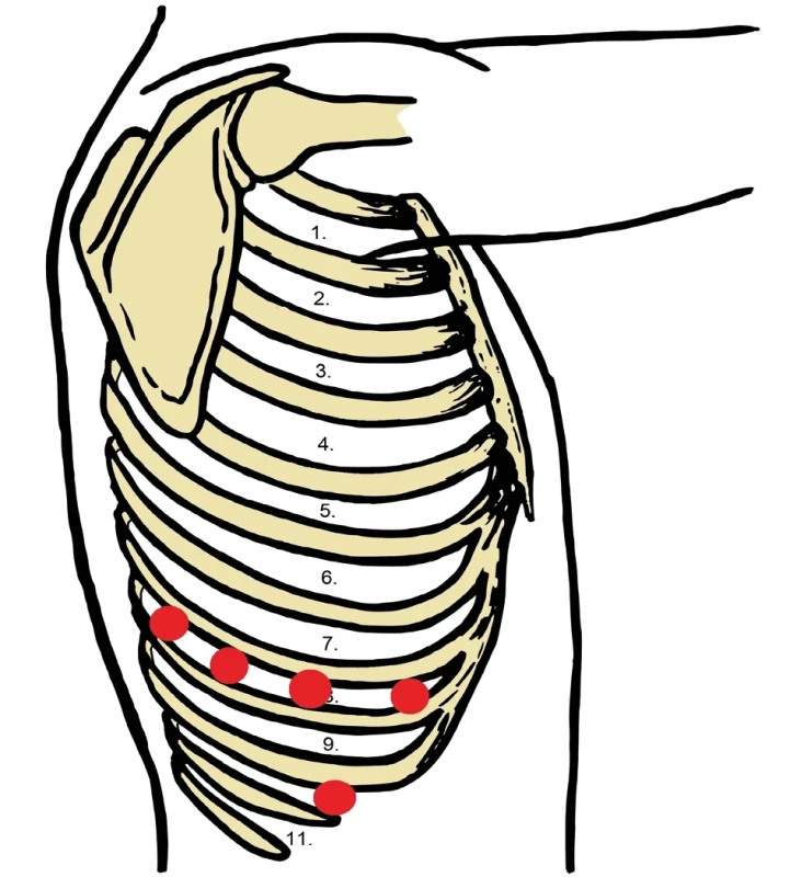 Schéma umístění portů   Fig. 2: Schematic of port locations