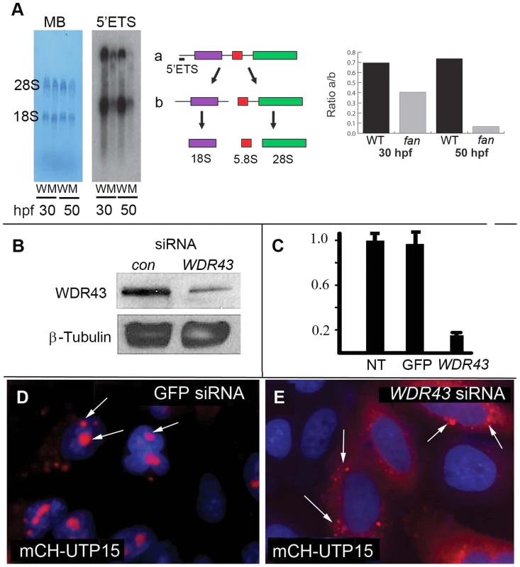 Ribosome biogenesis defects in <i>fan</i> mutant zebrafish.