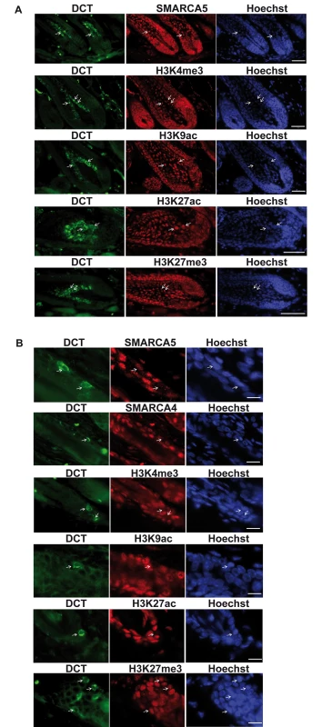 A transcriptionally repressed chromatin state in MSCs.