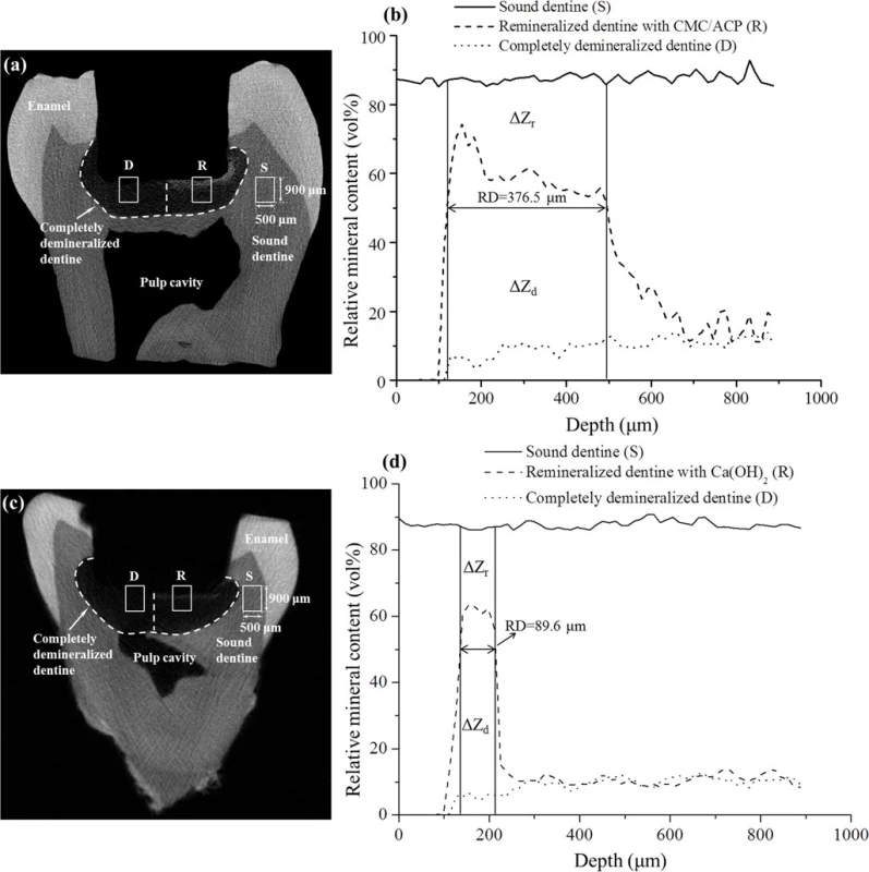 Representative Micro-CT images and mineral profiles of the samples of tooth model of deep caries. (a, b), CMC/ACP treatment group; (c, d), Ca(OH)<sub>2</sub> treatment group.