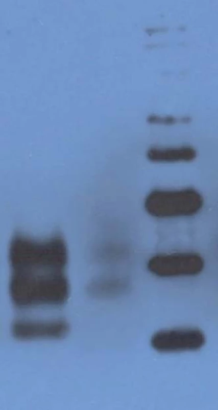 Western blot analysis.