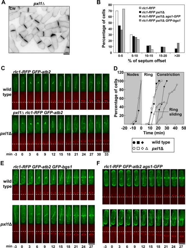 Pxl1 is required for stable CAR and septum positioning in the middle of the cell.
