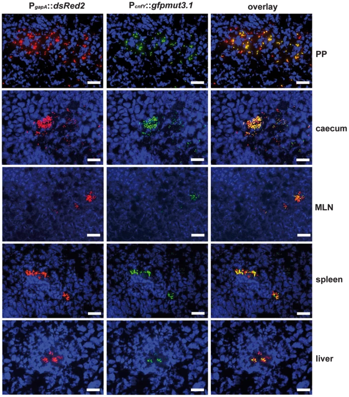 Expression of P<i><sub>cnfY</sub></i>::<i>gfp</i> in the lymphatic tissues and organs.