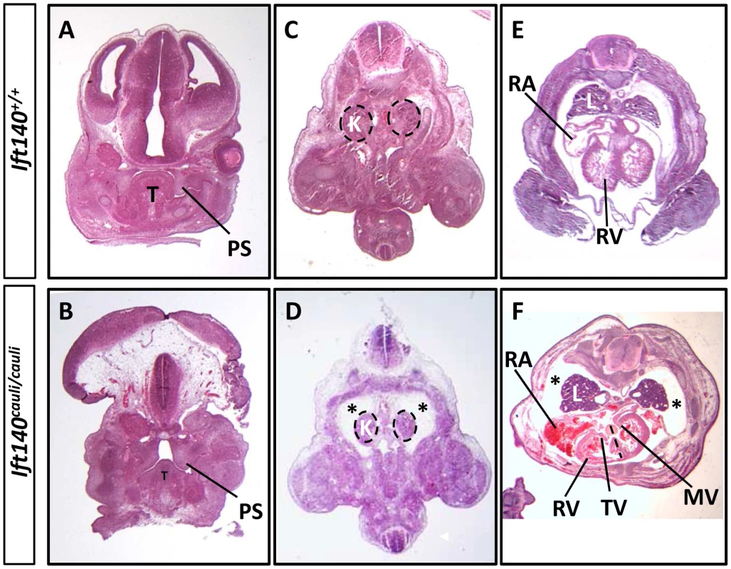 <i>Ift140<sup>cauli/caul</sup></i> mutants show palate defects, hydrops fetalis and malformation of the lungs and heart.