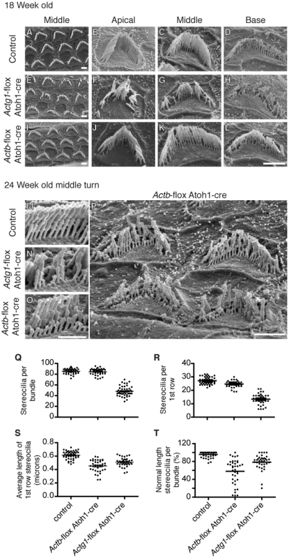 β-actin and γ-actin deficient stereocilia develop distinct pathology.