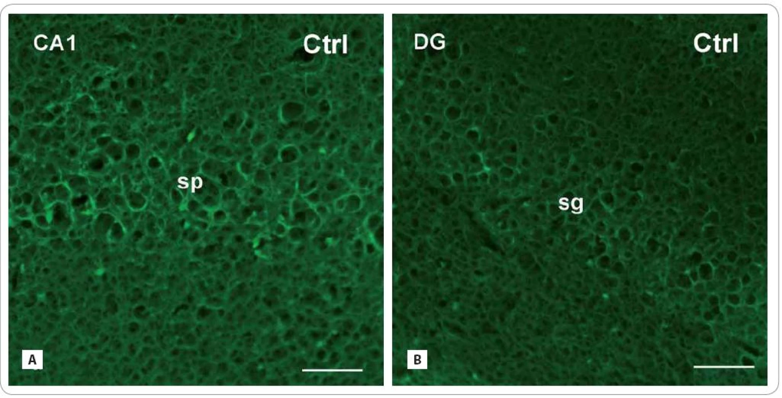 Photomicrographs of the sagittal sections through the hippocampus of adult rats showing the principal layers of the CA1 subfield and the DG: str. pyramidale (sp) and str. granulosum (sg), resp. Fluoro-Jade C histochemical method for detection of degenerating and dying neurons (green fluorescent somas) in control group (A, B) and in the brain of rats, investigated 30 and 100 days after fractionated irradiation (Irr-30, Irr-100) (C–F) with the total dose of 20 Gy of gamma rays.