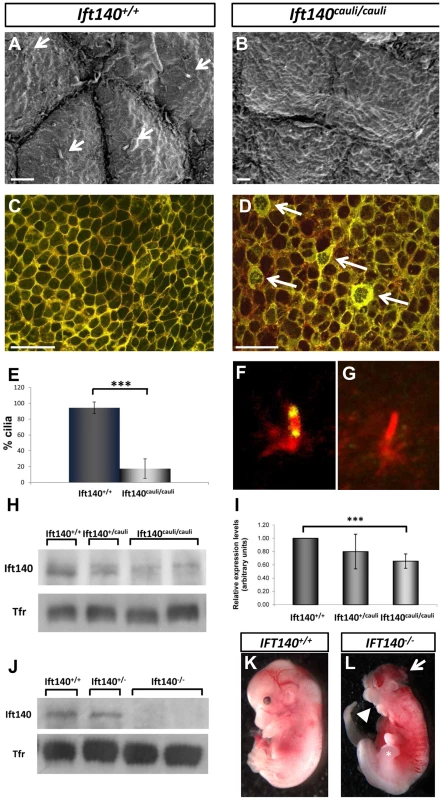 Epithelial cellular architecture and levels of Ift140 are altered in <i>Ift140<sup>cauli/caul</sup></i> mutants.