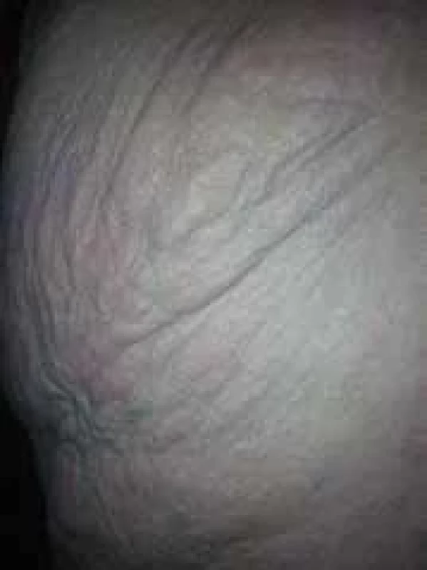 Elephant skin