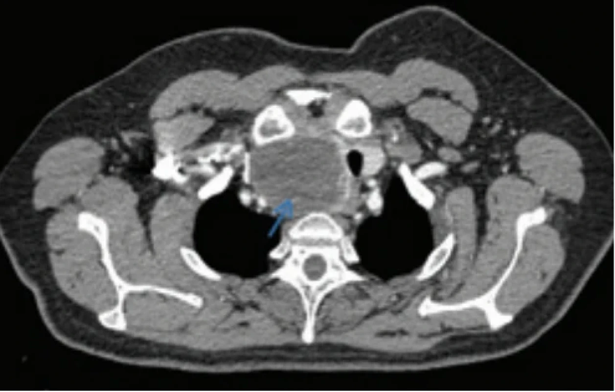 / Fig. 2.