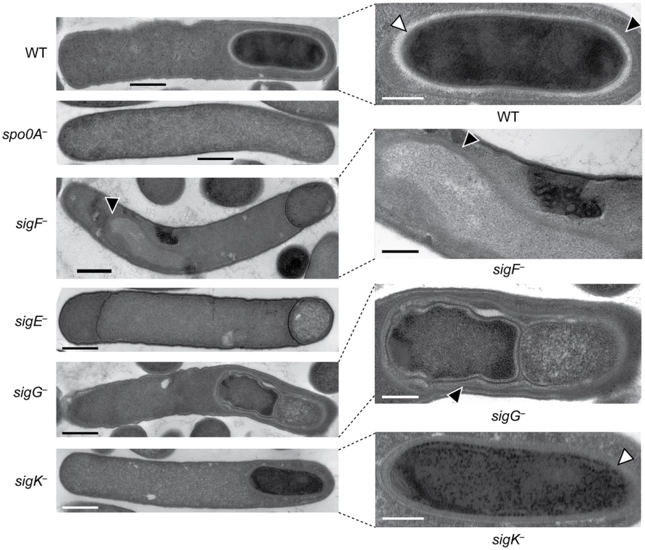 <i>C. difficile sigF</i><sup>−</sup>, <i>sigE<sup>−</sup></i>, <i>sigG<sup>−</sup></i>, and <i>sigK<sup>−</sup></i> mutants are arrested at different stages of spore formation.