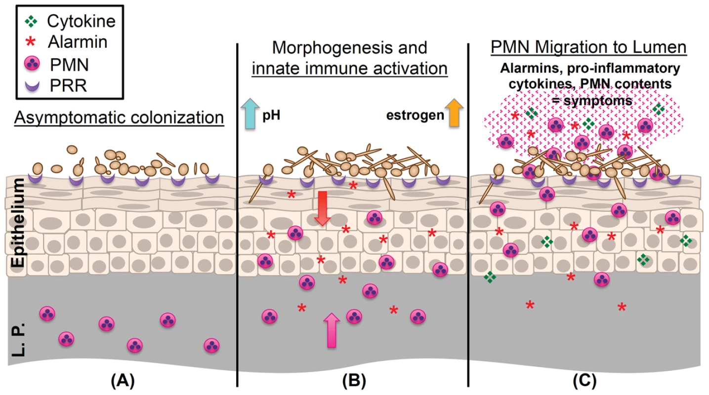Working model of the immunopathogenesis of <i>C. albicans</i> vaginitis.