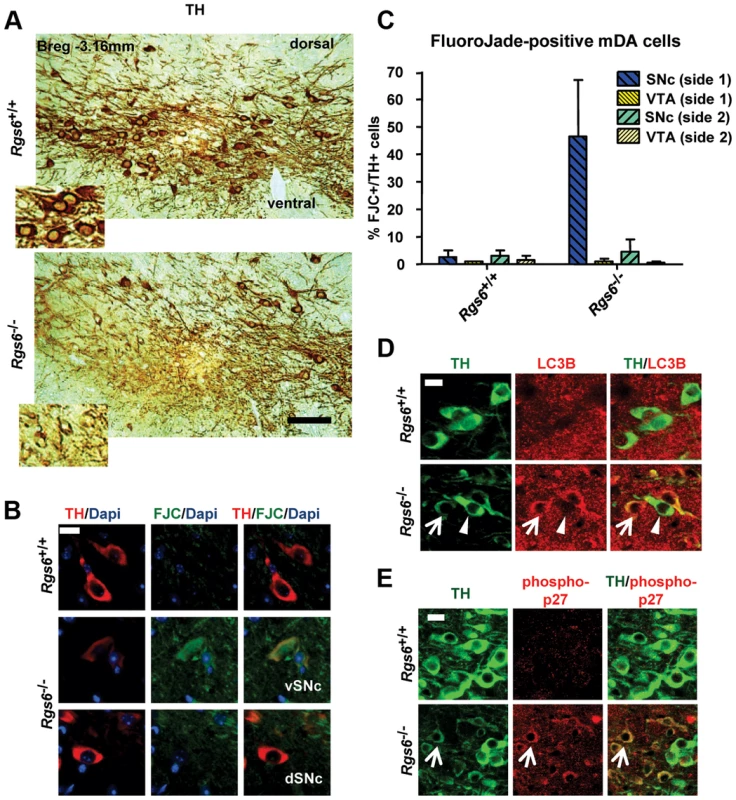 Unilateral degeneration of vSNc neurons in a subset of <i>Rgs6−/−</i> mice.