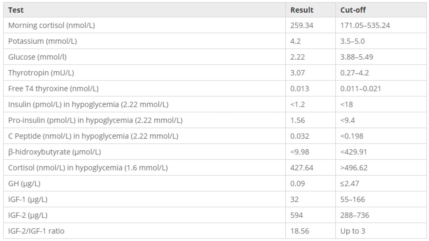 Laboratory tests confirming non-ketotic hypoinsulinemic
hypoglycemia by IGF2 production