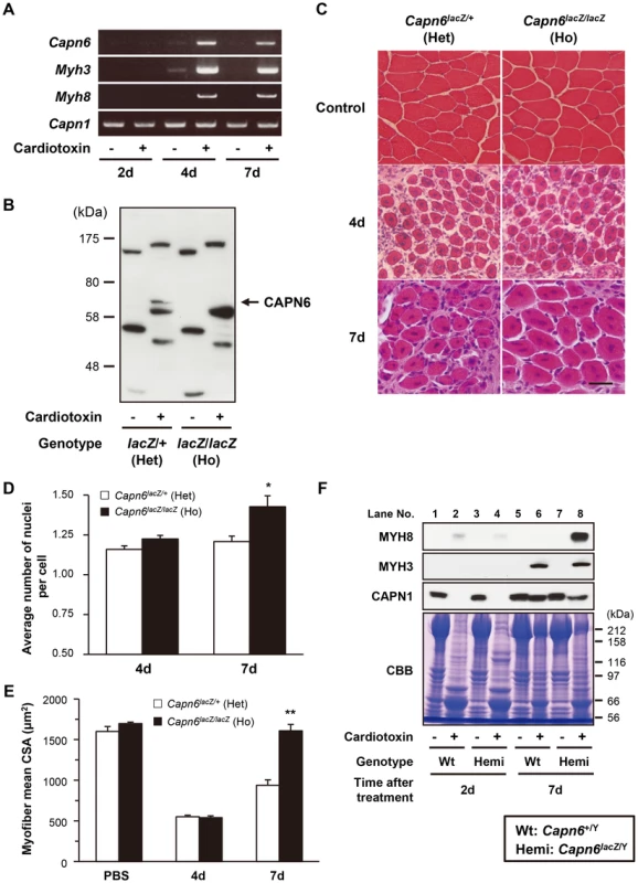 CAPN6 is expressed in regenerating skeletal muscles and suppresses regeneration.