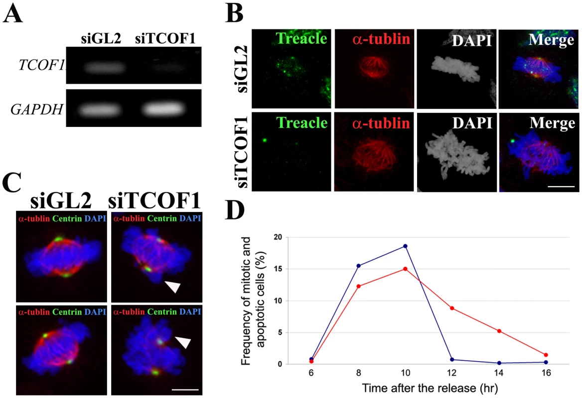Essential function of Treacle in mitotic spindle formation and mitotic progression.