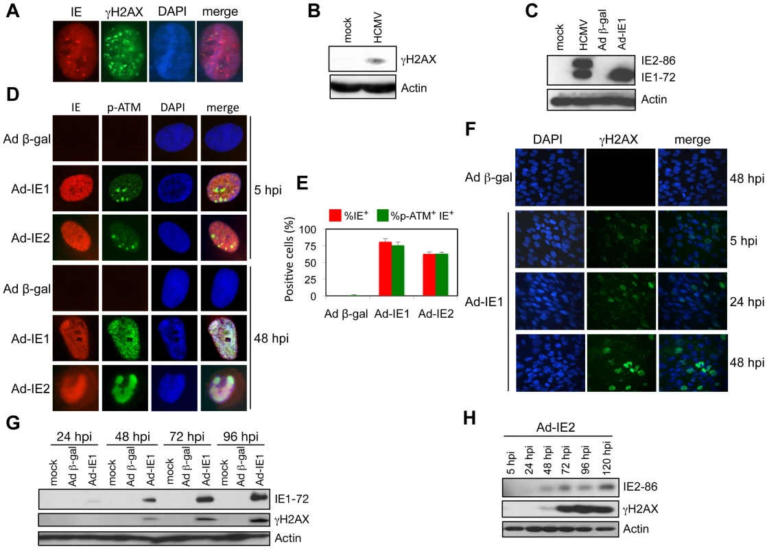 IE1 and IE2 expression induces a host DDR.