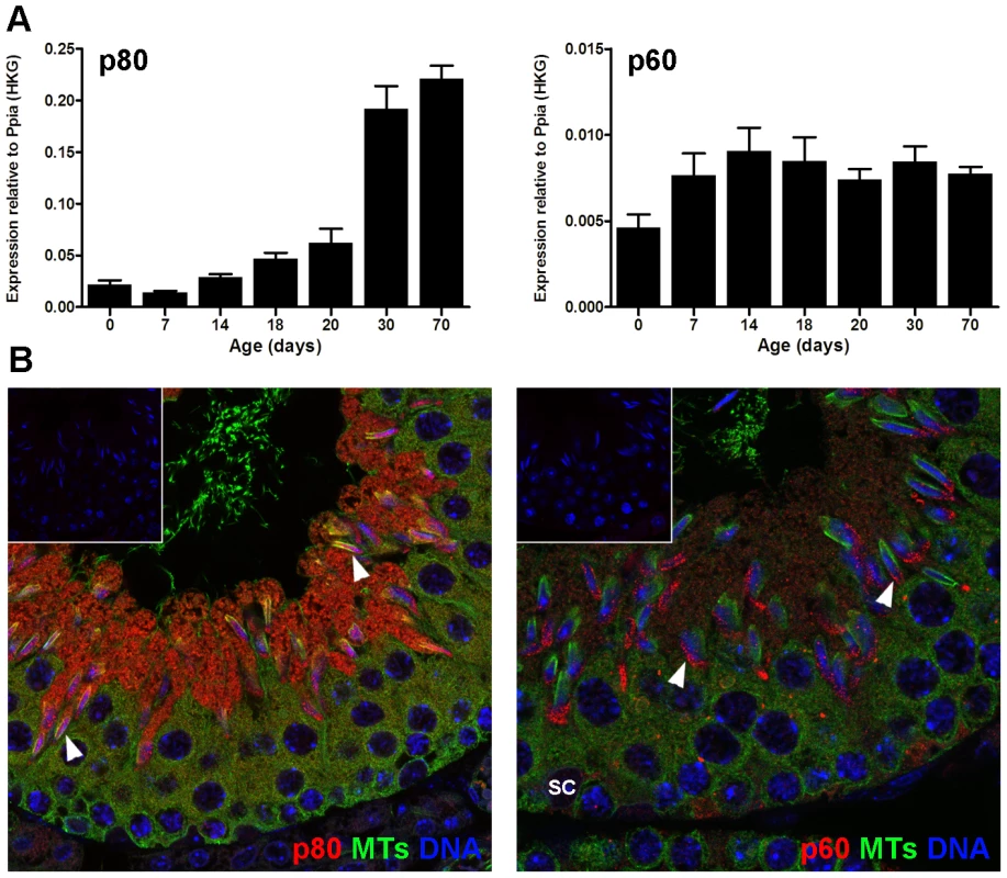 Katanin p60 and p80 expression in the mouse testis.