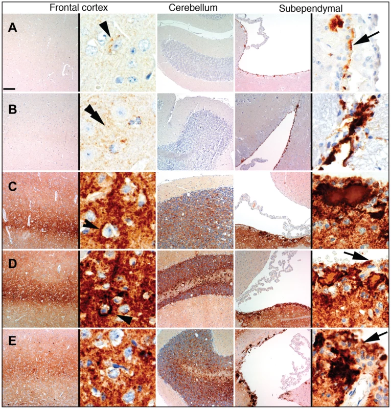 Comparison of PrP deposition at the early and late stages of the disease during the 3<sup>rd</sup> passage.
