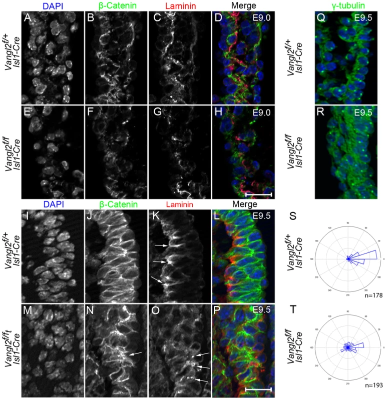 Disruption of epithelial organisation in the distal outflow tract of <i>Vangl2<sup>flox/flox</sup>; Isl1-Cre</i> embryos.