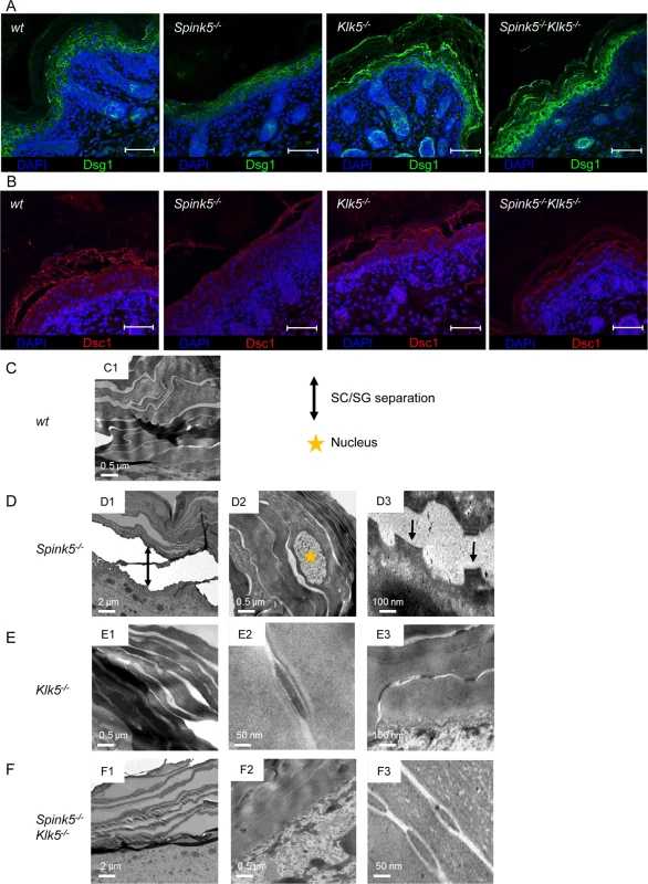 The ultrastructural architecture of <i>Spink5</i><sup><i>-/-</i></sup> epidermis is normalized by <i>Klk5</i> knockout.