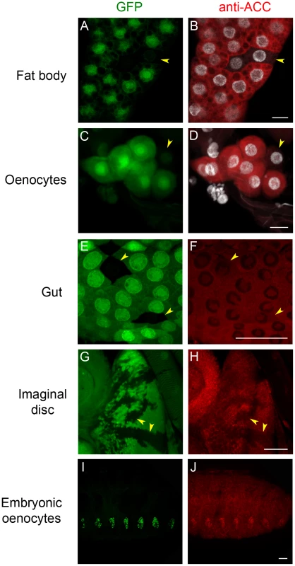 Immunodetection of ACC.