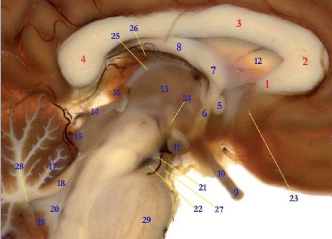 Mesencefalon, diencefalon, corpus callosum
1. Rostrum corporis callosi
2. Genu corporis callosi
3. Truncus corporis callosi
4. Splenium corporis callosi
5. Comissura anterior
Columna fornicis
6. Pars tecta
7. Pars libera
8. Corpus fornicis
9. Nervus opticus
10. Chiasma opticum
11. Corpus mamillare
12. Septum pellucidum
13. Thalamus(Ventr. III)
14. Colliculus rostralis
15. Colliculus caudalis
16. Glandula pinealis
17. Lingula cerebelli
18. Vellum medullare rostrale
19. Plexus choroideus
20. Ventriculus IV
21. Nervus oculomotorius
22. Fossa interpeduncularis
23. Gyrus paraterminalis
24. Fasciculus mamillothalamicus
25. Stria medullaris thalami
26. Vellum interpositum with veins
27. Crus cerebri
28. Fastigium
29. Pars ventralis pontis