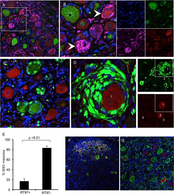VZV replication is restricted in mechanoreceptive neurons.