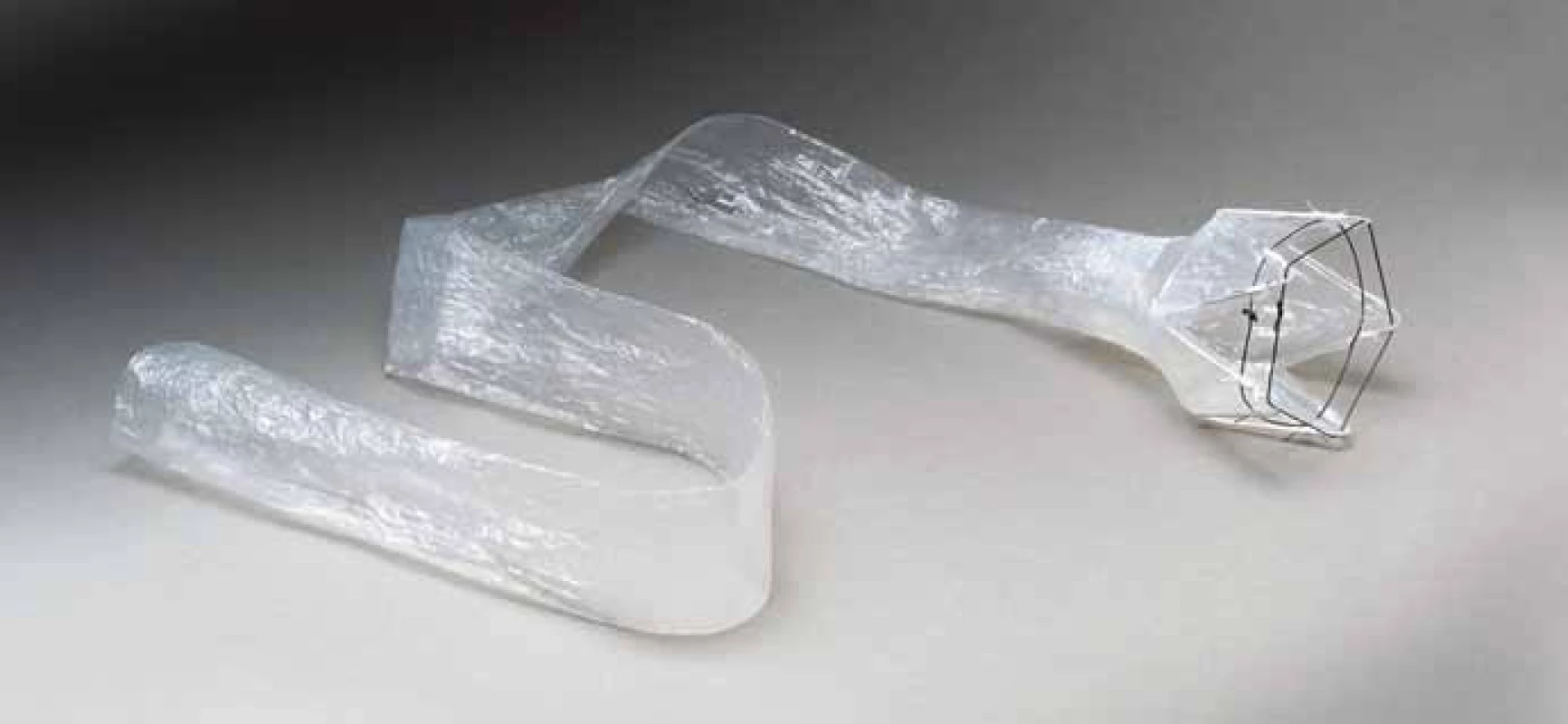 DJBL (EndoBarrier<sup>®</sup>).
Fig.1. DJBL (EndoBarrier<sup>®</sup>).