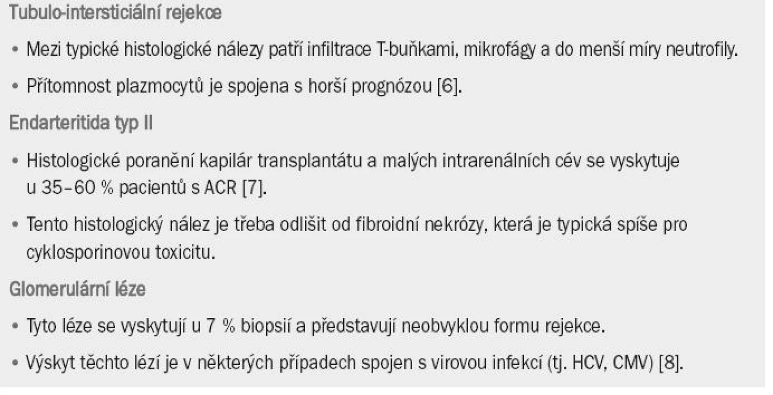 Akutní buněčná rejekce (ACR) vyvolaná T-buňkami.
