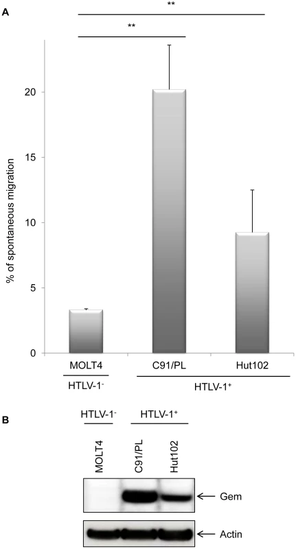 Gem expression level is correlated to cell migration.