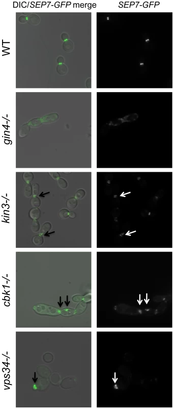 Septins are mislocalized in some PK mutant strains.