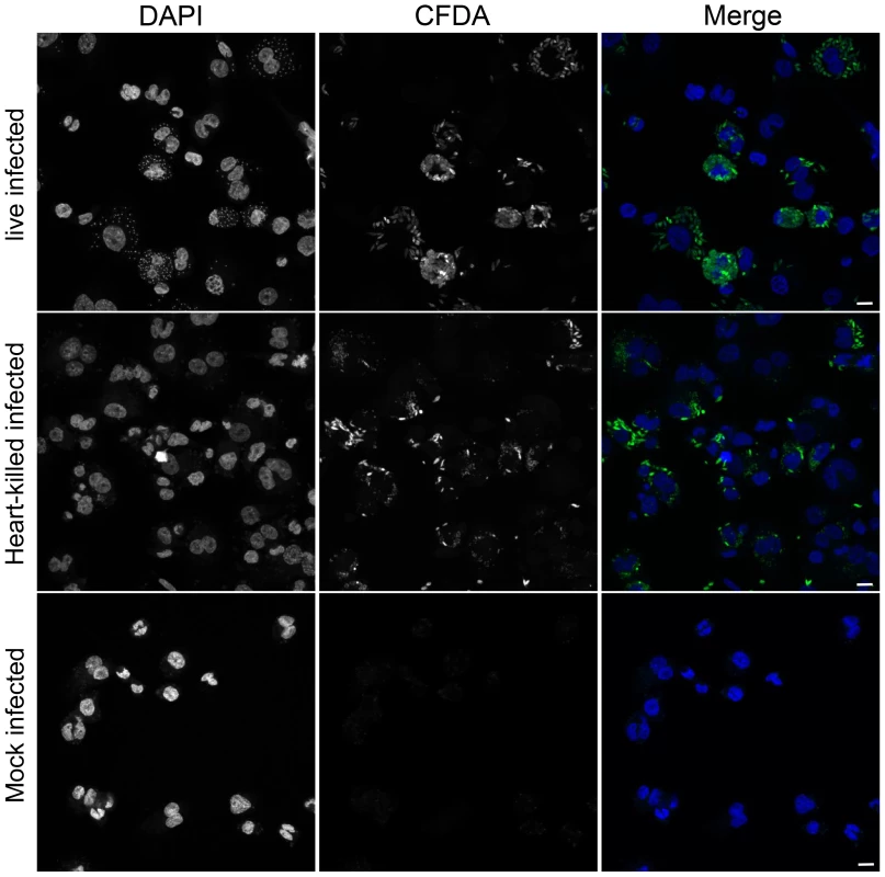 Heat-killed <i>L. donovani</i> are phagocytosed by THP1 cells.
