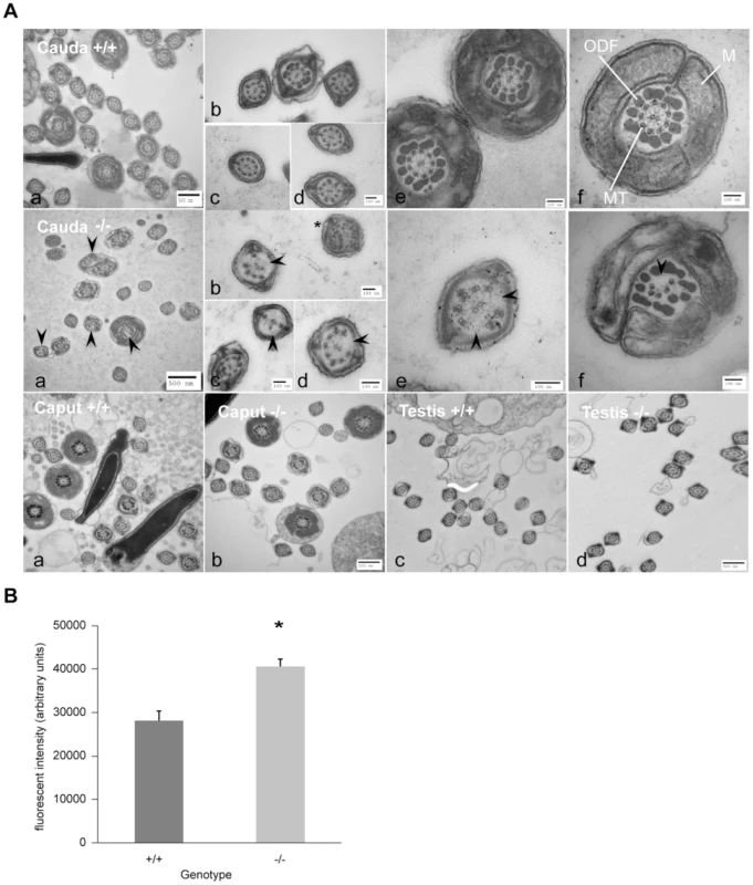 Ultrastructure of spermatozoa from cauda, caput and testis from wild-type littermates (+/+) and <i>DefbΔ9/DefbΔ9</i> (−/−) male mice reveals a defect in microtubule structure.