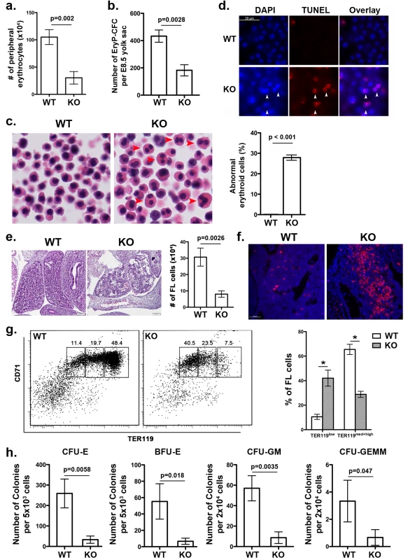 <i>UFBP1</i> deficiency impairs embryonic erythroid development.