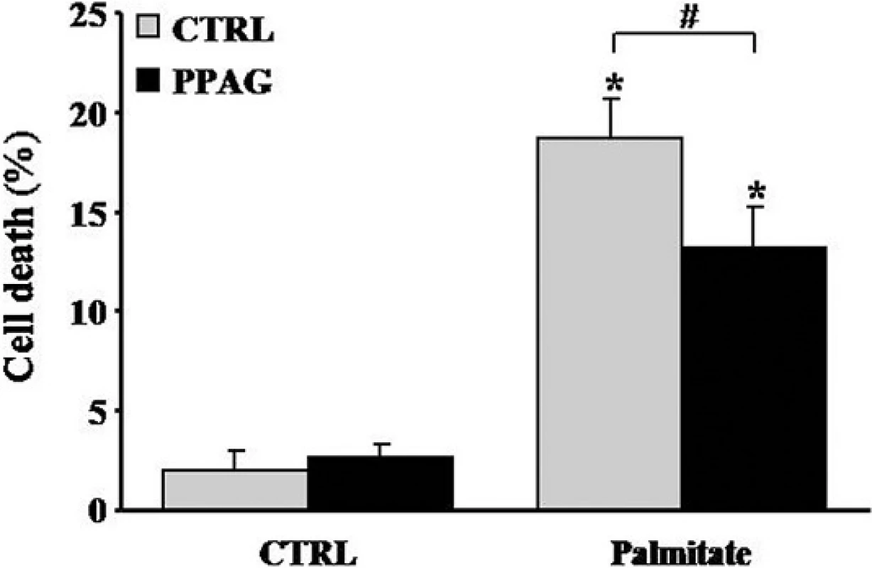 Effect of PPAG on lipotoxic cell death in human islet cells. Human islets were treated with 0.5 mM palmitate and 30 μM PPAG or vehicle for 3 days (n = 4). The percentage of apoptotic (A) and necrotic cells (B) was determined following staining with the nuclear dyes propidium iodide and Hoechst 33342. A minimum of 500 cells was counted for each condition. *p<0.05 against untreated cells, #p< 0.05 as indicated.
