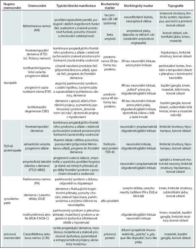 Srovnání typických klinických projevů a neuropatologických markerů neurodegenerativních demencí [34].