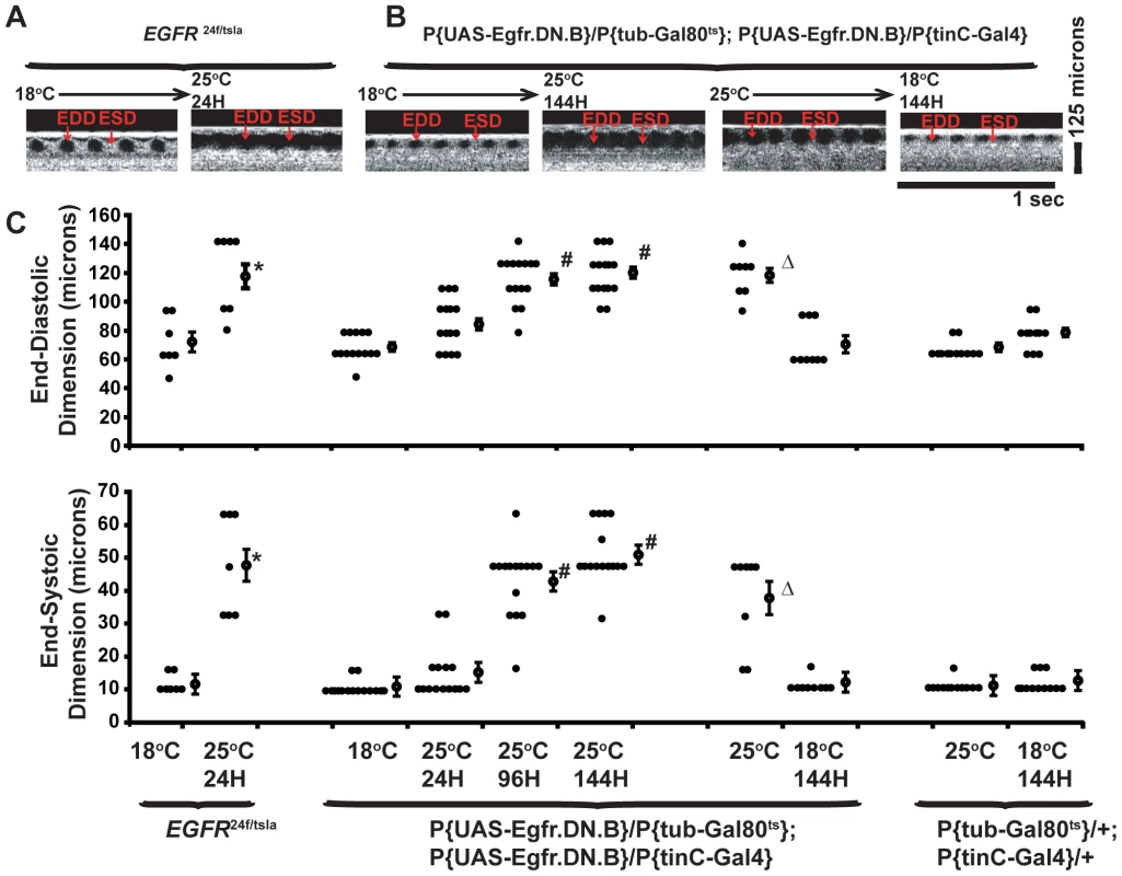Cardiac expression of dominant negative EGFR (EGFR.DN) causes a progressive post-developmental enlarged heart and impaired systolic function in adult <i>Drosophila</i>.