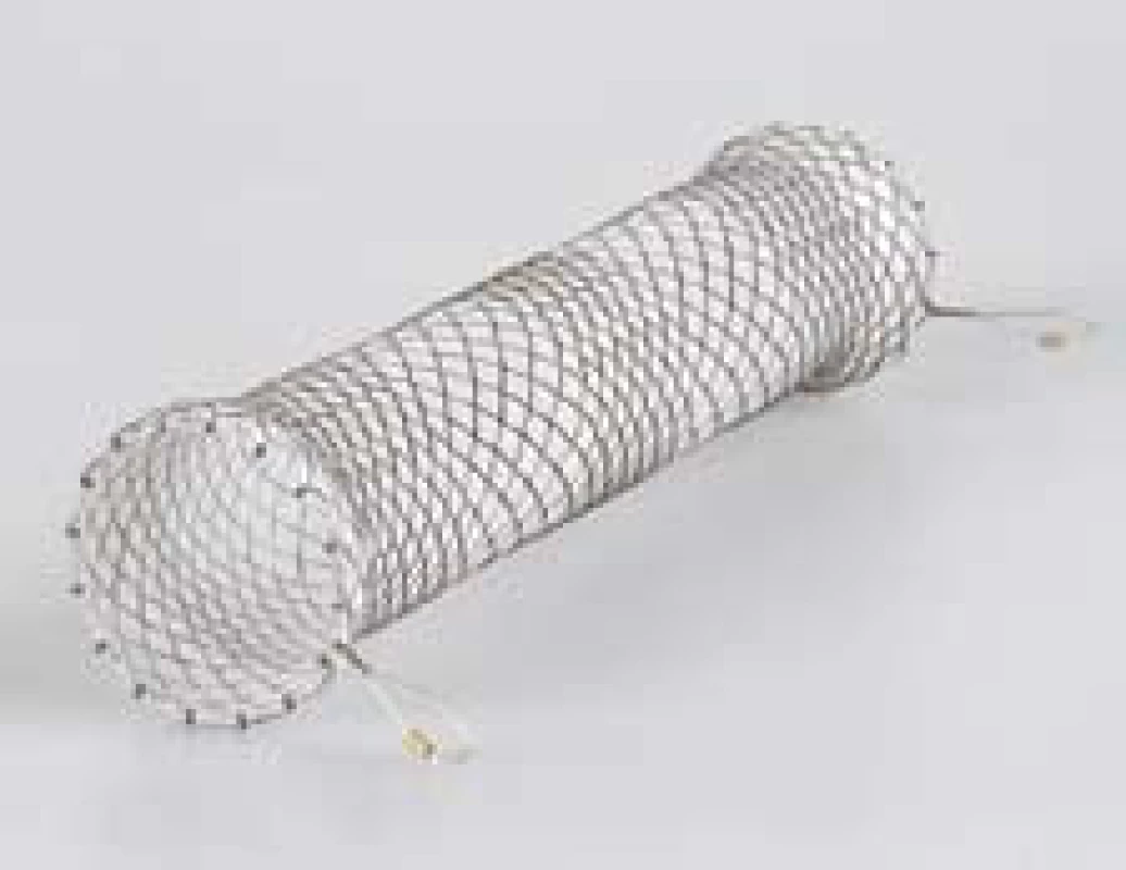 Potahovaný jícnový stent – (SX Ella stent Danis<sup>®</sup>).
Fig. 2. Coated oesophageal stent – (SX Ella stent Danis<sup>®</sup>).