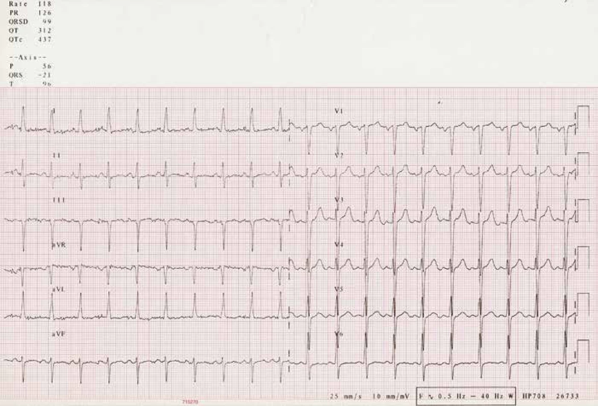 EKG při přijetí v roce 2006.