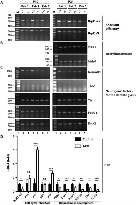 Brpf1 loss deregulates gene expression important for hippocampus development.