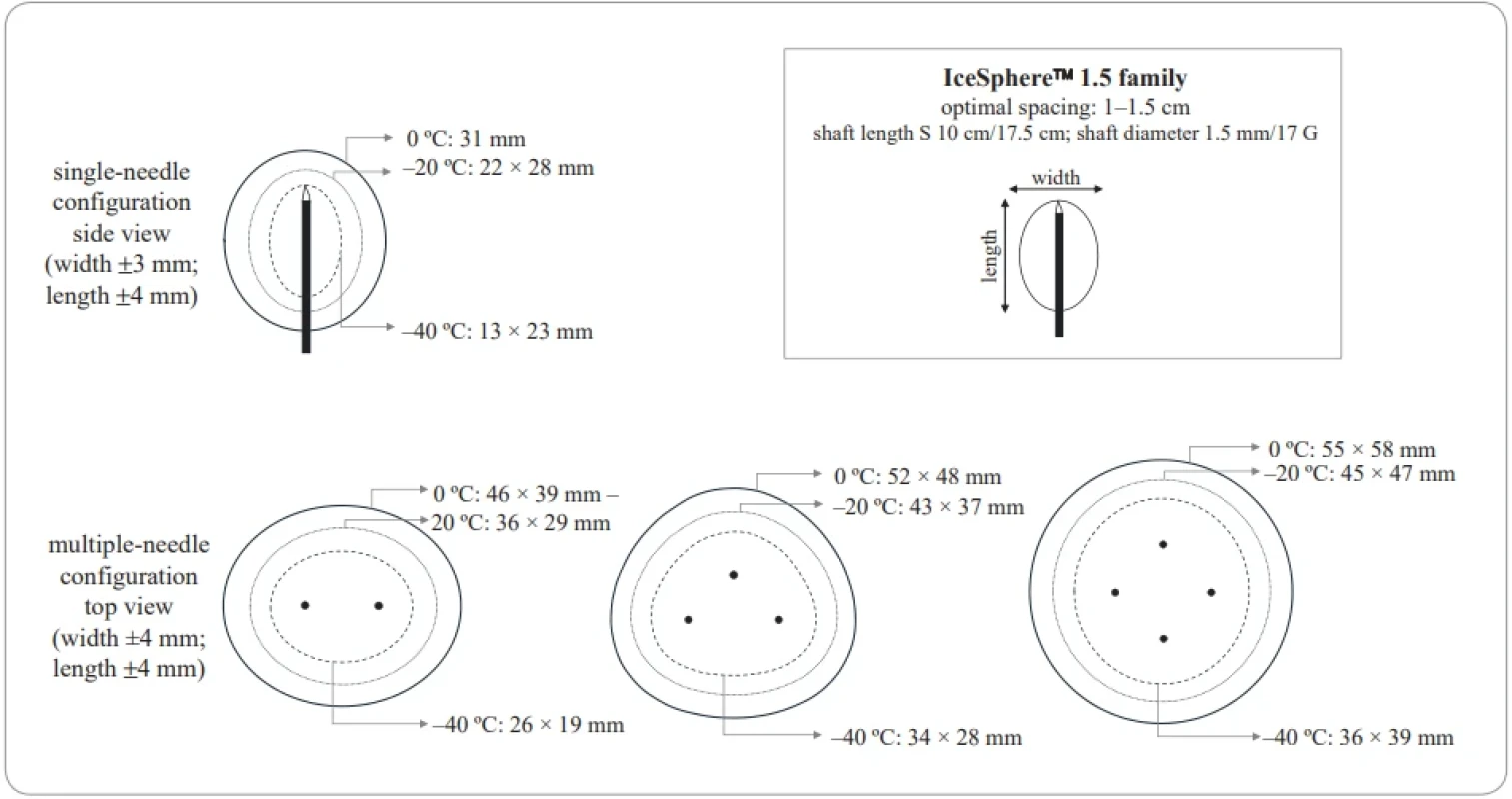 Graphical representation by the authors based on data reported by Boston Scientifi c. Dimensions of the ice balls generated by the IceSphere™ needle in single or multiple confi guration; data obtained in gel at 37 °C [14].